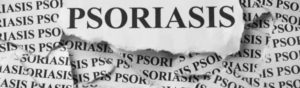 Le psoriasis, l’étrange rébellion épidermique !
