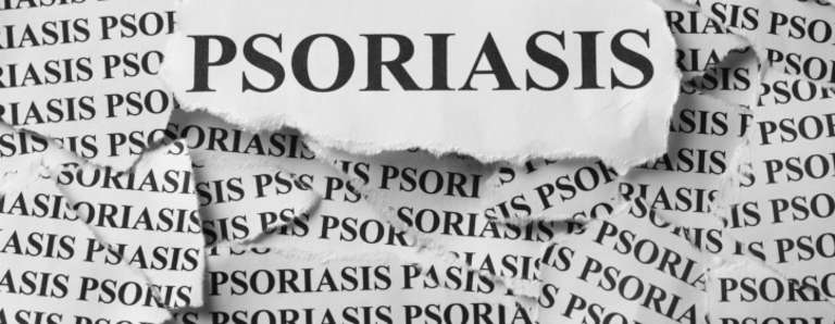 Le psoriasis, l’étrange rébellion épidermique !