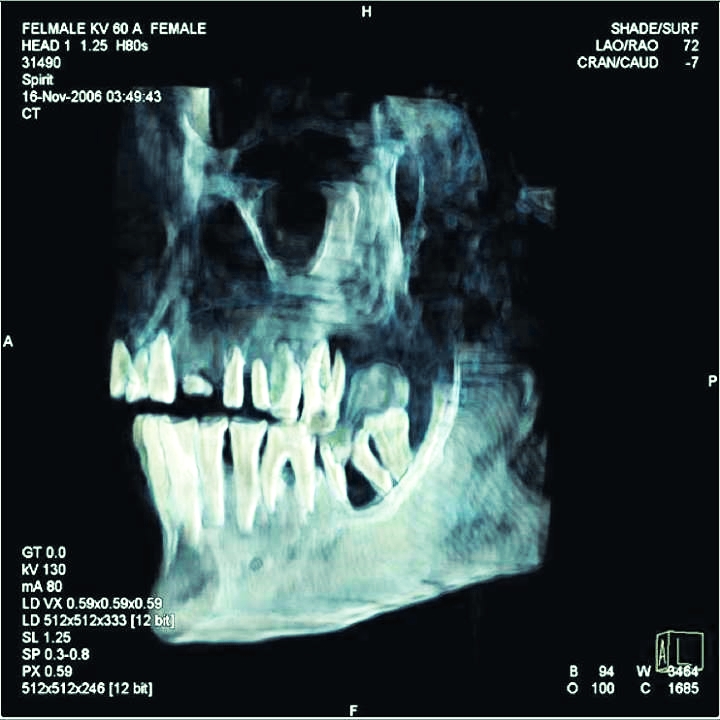 3500 ans et presque toutes ses dents !